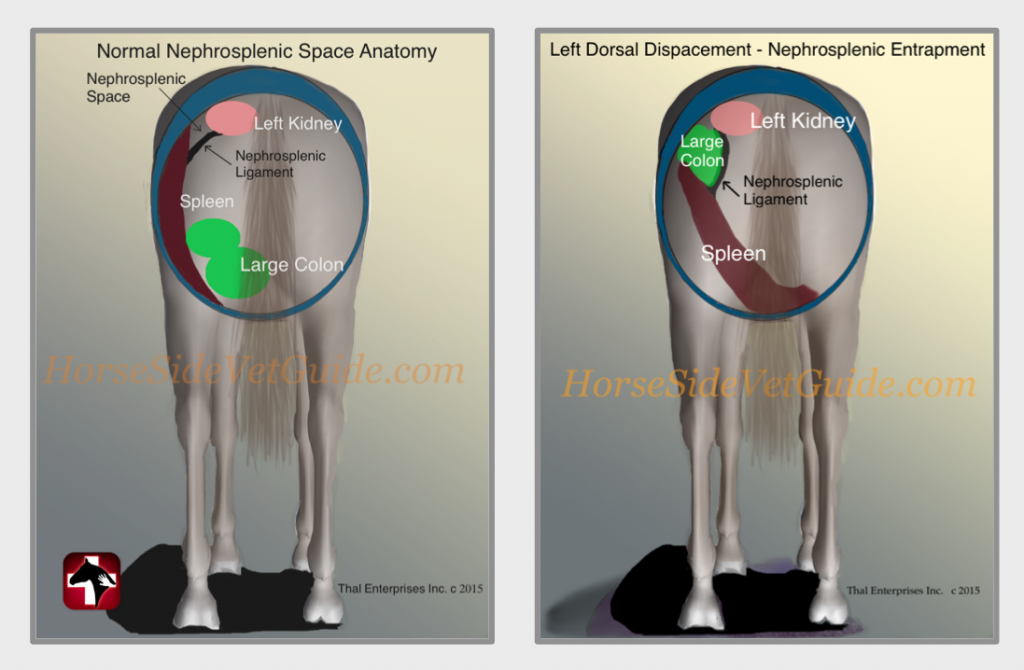 LDD Normal & Entrapment