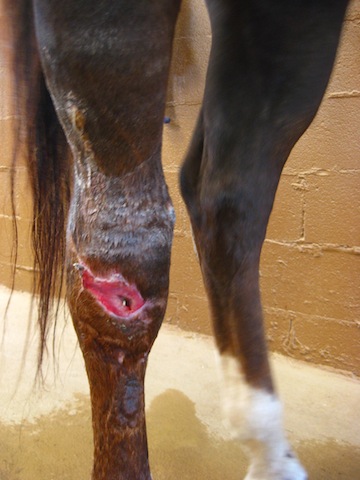 Leg Wound