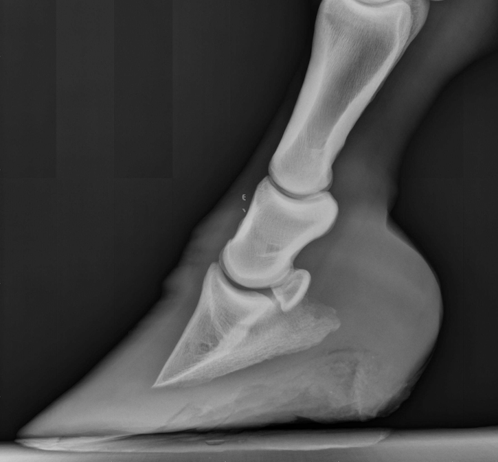 Radiograph - Laminitis, Mild Rotation 