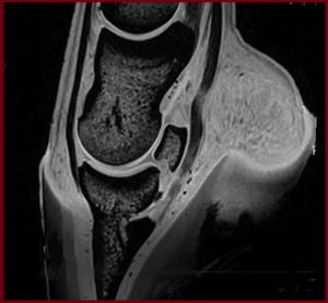 3 DT modified MRI distal limb navicular