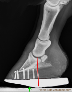 Radiograph showing mechanics of the roller motion shoe, one way to address navicular syndrome. 